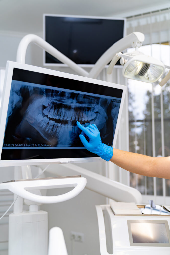 Teeth professional examining x ray. Dentistry radiography treatment.
